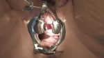 bigger Speculum in Peehole of Slave B Part II