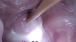 Insertion Semen Cum in Cervix Wide Stretching Pussy Speculum