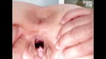 Rachael pussy gyno speculum fetish examined